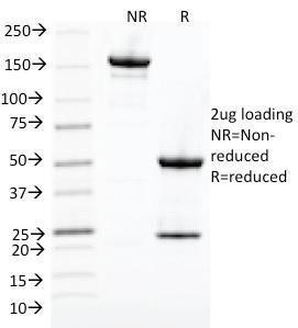 SDS-PAGE analysis of Anti-CDK1 Antibody [POH-1] under non-reduced and reduced conditions; showing intact IgG and intact heavy and light chains, respectively. SDS-PAGE analysis confirms the integrity and purity of the antibody