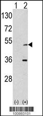 Anti-AURKA Rabbit Polyclonal Antibody