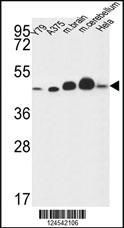 Anti-NDUFS2 Rabbit Polyclonal Antibody