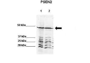 Anti-PSEN2 Rabbit Polyclonal Antibody