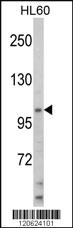 Anti-CCDC22 Rabbit Polyclonal Antibody