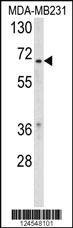 Anti-RXRB Rabbit Polyclonal Antibody