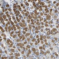 Anti-OTOF Rabbit Polyclonal Antibody