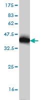 Anti-TXN Mouse Monoclonal Antibody [clone: 6C10]