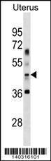 Anti-ATG4B Rabbit Polyclonal Antibody (AP (Alkaline Phosphatase))