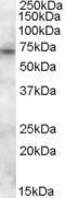 Anti-ABCD3 Antibody (A82590) (0.2µg/ml) staining of Human Kidney lysate (35µg protein in RIPA buffer). Primary incubation was 1 hour. Detected by chemiluminescence.