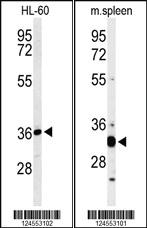 Anti-ZDHHC6 Rabbit Polyclonal Antibody