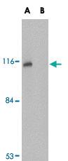 Anti-JPH3 Rabbit Polyclonal Antibody