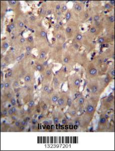 Anti-SEC63 Rabbit Polyclonal Antibody (HRP (Horseradish Peroxidase))