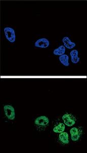 Anti-PLA2G4A Rabbit Polyclonal Antibody (HRP (Horseradish Peroxidase))