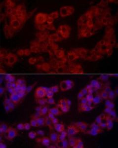 Immunofluorescence analysis of HepG2 cells using Anti-Leptin Antibody (A11435) at a dilution of 1:100 (40X lens). DAPI was used to stain the cell nuclei (blue)