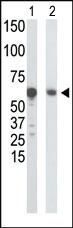 Anti-GCK Rabbit Polyclonal Antibody