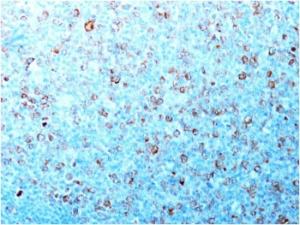 Immunohistochemical analysis of formalin-fixed, paraffin-embedded human tonsil using Anti-CDK1 Antibody [CDK1/873]