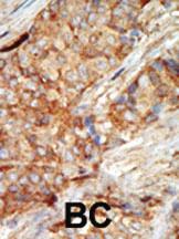 Anti-GCK Rabbit Polyclonal Antibody