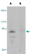 Anti-JPH4 Rabbit Polyclonal Antibody