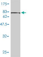 Anti-CCT5 Mouse Monoclonal Antibody [clone: 4E5-4B1]