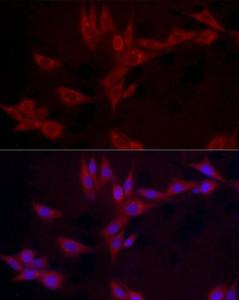 Immunofluorescence analysis of NIH/3T3 cells using Anti-Leptin Antibody (A11435) at a dilution of 1:100 (40X lens). DAPI was used to stain the cell nuclei (blue)