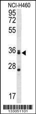 Anti-MBNL3 Rabbit Polyclonal Antibody (AP (Alkaline Phosphatase))