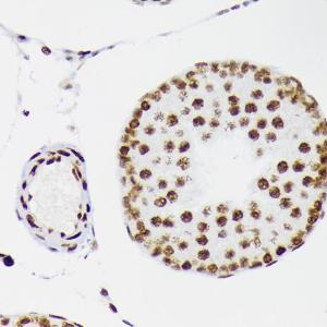 Immunohistochemistry analysis of paraffin-embedded rat testis using Anti-LIG1 Antibody [ARC1514] (A307677) at a dilution of 1:100 (40x lens). Perform microwave antigen retrieval with 10 mM Tris/EDTA buffer pH 9.0 before commencing with IHC staining protocol.