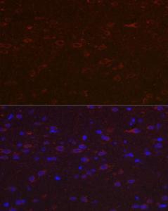 Immunofluorescence analysis of rat brain cells using Anti-Versican Antibody (A308869) at a dilution of 1:100 (40X lens). DAPI was used to stain the cell nuclei (blue)