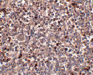 Anti-PIGY Rabbit Polyclonal Antibody