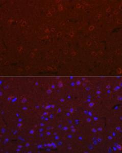 Immunofluorescence analysis of mouse brain cells using Anti-Versican Antibody (A308869) at a dilution of 1:100 (40X lens). DAPI was used to stain the cell nuclei (blue)