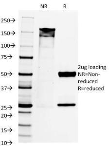 SDS-PAGE analysis of Anti-PAX8 Antibody [PAX8/1492] under non-reduced and reduced conditions; showing intact IgG and intact heavy and light chains, respectively. SDS-PAGE analysis confirms the integrity and purity of the antibody.