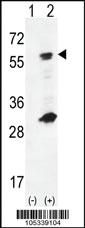 Anti-GCK Rabbit Polyclonal Antibody