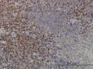 Anti-PRKCA Mouse Monoclonal Antibody [clone: 2F11]