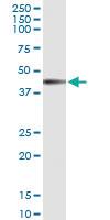 Anti-IL12RB1 Polyclonal Antibody Pair