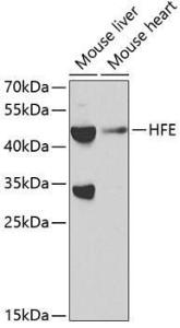 Anti-HFE Antibody (A11436)