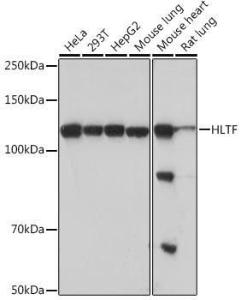 Western blot analysis of extracts of various cell lines, using Anti-HLTF Antibody [ARC1982] (A308870) at 1:1,000 dilution. The secondary antibody was Goat Anti-Rabbit IgG H&L Antibody (HRP) at 1:10,000 dilution.