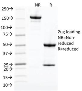 SDS-PAGE analysis of Anti-CDK1 Antibody [CDK1/873] under non-reduced and reduced conditions; showing intact IgG and intact heavy and light chains, respectively. SDS-PAGE analysis confirms the integrity and purity of the Antibody