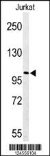 Anti-PAQR8 Rabbit Polyclonal Antibody