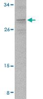 Anti-PIGY Rabbit Polyclonal Antibody