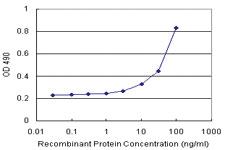 Anti-TREM1 Antibody Pair