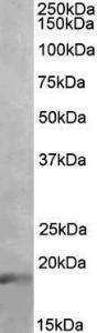 Anti-IL17A antibody