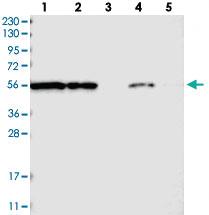 Anti-FKBP9 Rabbit Polyclonal Antibody