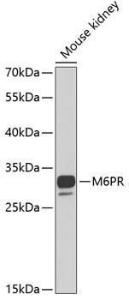 Anti-M6PR (cation dependent) Rabbit Polyclonal Antibody