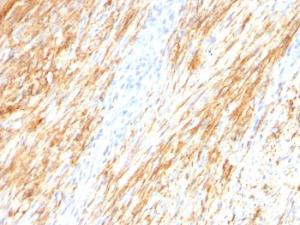 Antibody anti-GFAP astro 789 100 µg