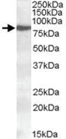 Anti-ALOX15 Goat Polyclonal Antibody