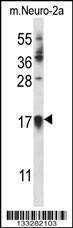 Anti-CDKN1A Rabbit Polyclonal Antibody (APC (Allophycocyanin))