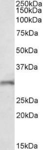 Anti-FGF14 Antibody (A82593) (1µg/ml) staining of Mouse Brain lysate (35µg protein in RIPA buffer). Detected by chemiluminescence.