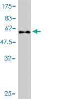 Anti-PRKAB2 Mouse Monoclonal Antibody [clone: 2G9]