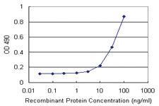 Anti-MAGED1 Polyclonal Antibody Pair