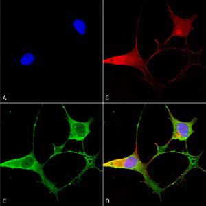 Immunocytochemistry/Immunofluorescence analysis of human neuroblastoma cells (SH-SY5Y), fixed in 4% PFA for 15  min, using Anti-Ankyrin B Antibody [S105-13] (A304742), at 1:50 for overnight at 4 °C with slow rocking.