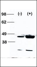 Anti-MAP2K1 Rabbit Polyclonal Antibody