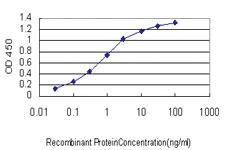 Anti-MCPH1 Mouse Monoclonal Antibody [clone: 5C9]