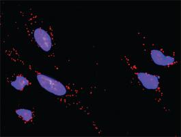 Anti-GRAP2 + ERBB2 Antibody Pair