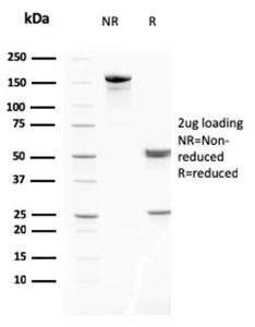 SDS-PAGE analysis of Anti-MMP3 Antibody [MMP3/2806] under non-reduced and reduced conditions; showing intact IgG and intact heavy and light chains, respectively. SDS-PAGE analysis confirms the integrity and purity of the antibody